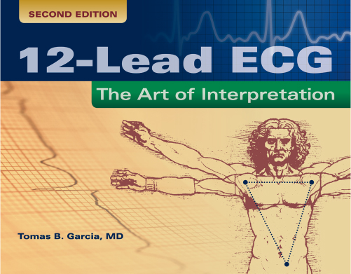 12-Lead ECG The Art of Interpretation Second Edition ISBN 9780763773519 - photo 7