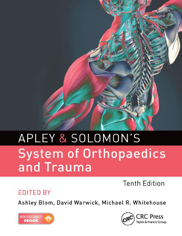 Apley and Solomons System of Orthopaedics and Trauma Alan Graham Apley - photo 1