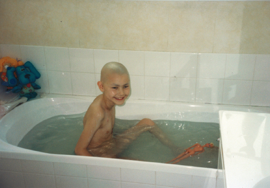 My first bath following the amputation and rotationplasty At the Limb - photo 15