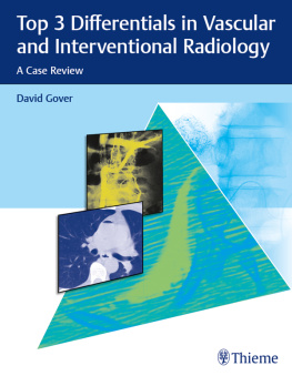 David D. Gover Top 3 Differentials in Vascular and Interventional Radiology: A Case Review