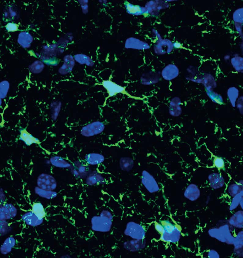 Gardening in the brain microglia green cells visualised in the hippocampus - photo 17