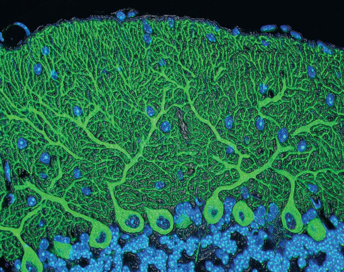 Neurons and plants grow according to the same mathematical laws cerebellar - photo 18