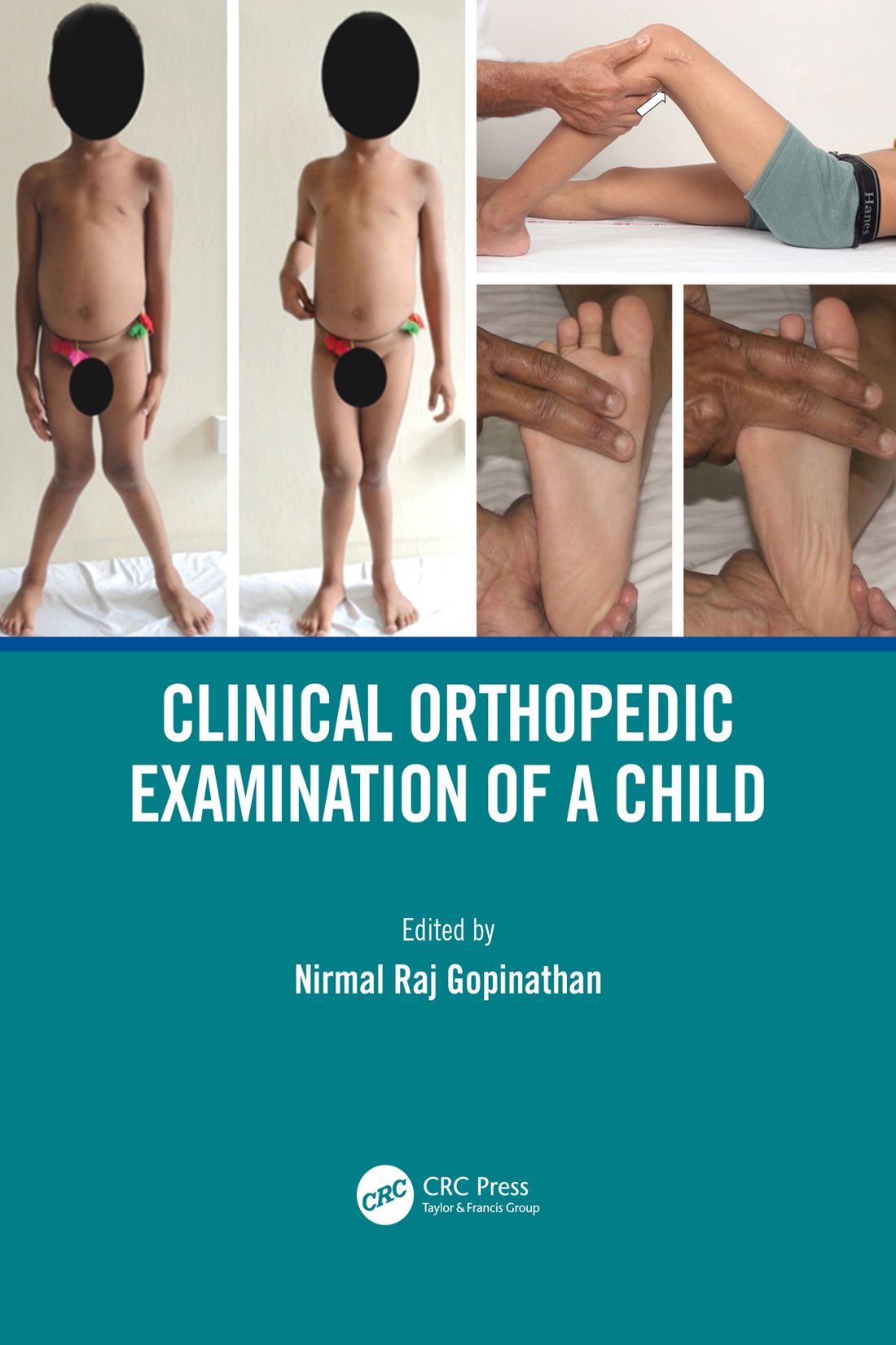 Clinical Orthopedic Examination of a Child Clinical Orthopedic Examination of a - photo 1