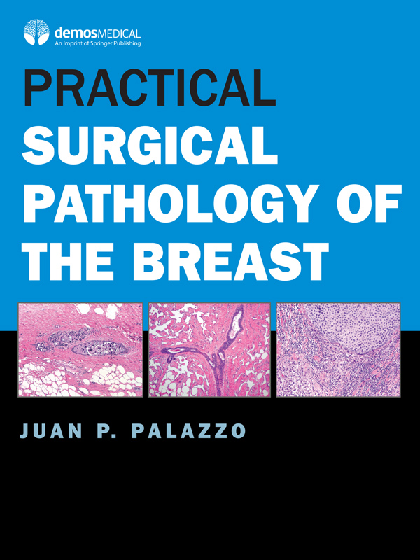 i Practical Surgical Pathology of the Breast ii iii Practical Surgical - photo 1