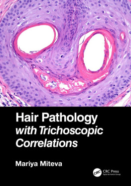 Mariya Miteva Hair Pathology with Trichoscopic Correlations