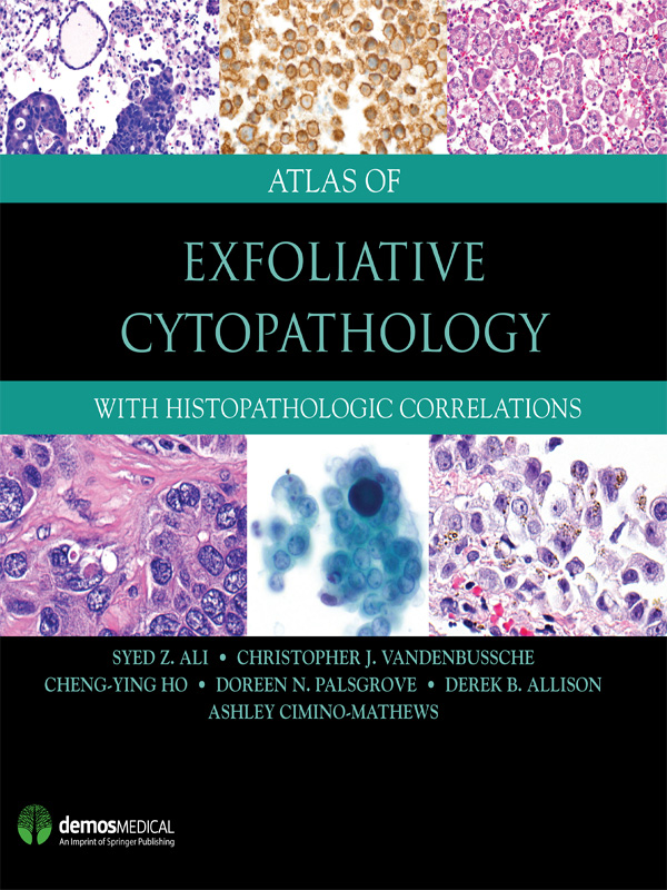 i Atlas of Exfoliative Cytopathology ii Syed Z Ali MD FRCPath FIAC - photo 1