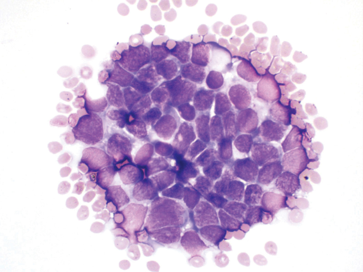 Atlas of Exfoliative Cytopathology With Histopathologic Correlations iv - photo 3