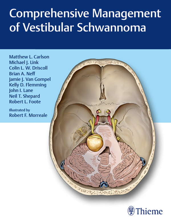 Comprehensive Management of Vestibular Schwannoma - image 1