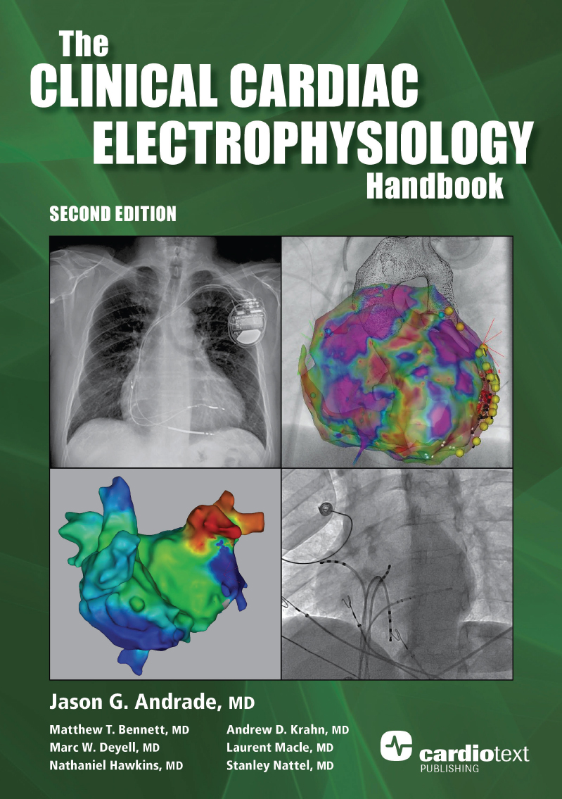 THE CLINICAL CARDIAC ELECTROPHYSIOLOGY HANDBOOK SECOND EDITION Jason G - photo 1