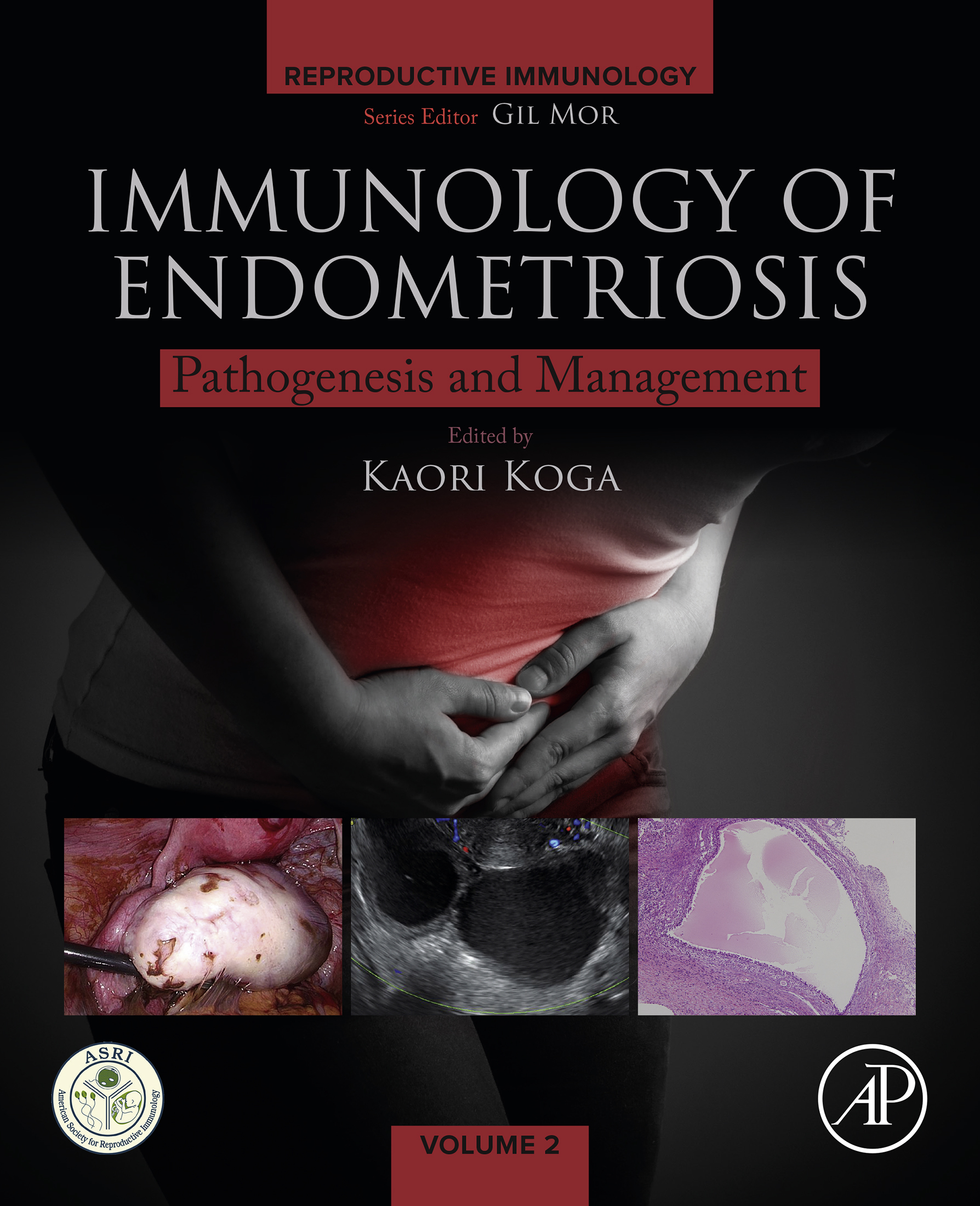 Immunology of Endometriosis Pathogenesis and Management Editor Kaori Koga - photo 1