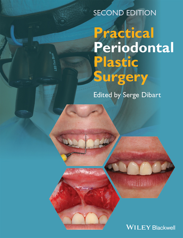 PRACTICAL PERIODONTAL PLASTIC SURGERY SECOND EDITION Edited by Serge Dibart - photo 1