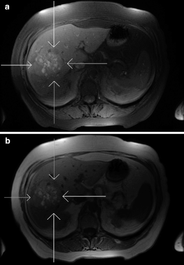 Image 6 Image 7 Dynamic post-gadolinium fat sat T1 scans Images 7ad - photo 12