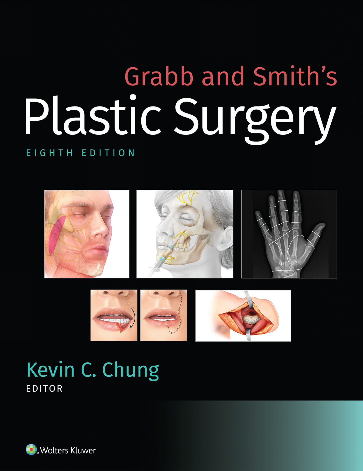 Grabb and Smiths Plastic Surgery Eighth Edition Editor-In-Chief Kevin C - photo 1