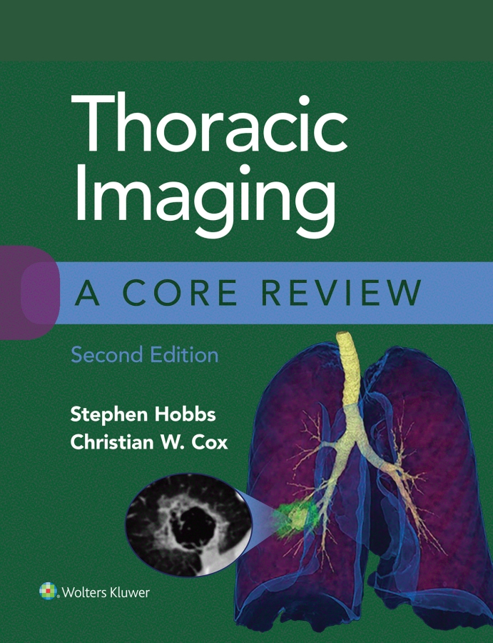 Thoracic Imaging A Core Review SECOND EDITION Thoracic Imaging A Core Review - photo 1