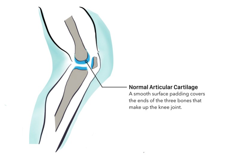 Smooth durable tissue that facilitates low-friction joint motion The bones - photo 2