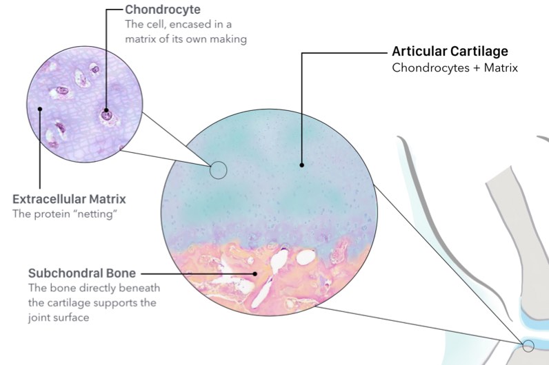 Articular cartilage under the microscope Articular cartilage is made up of a - photo 3