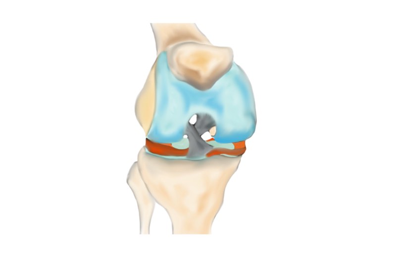 As you walk your knee straightens and bends The articular cartilage surfaces - photo 10