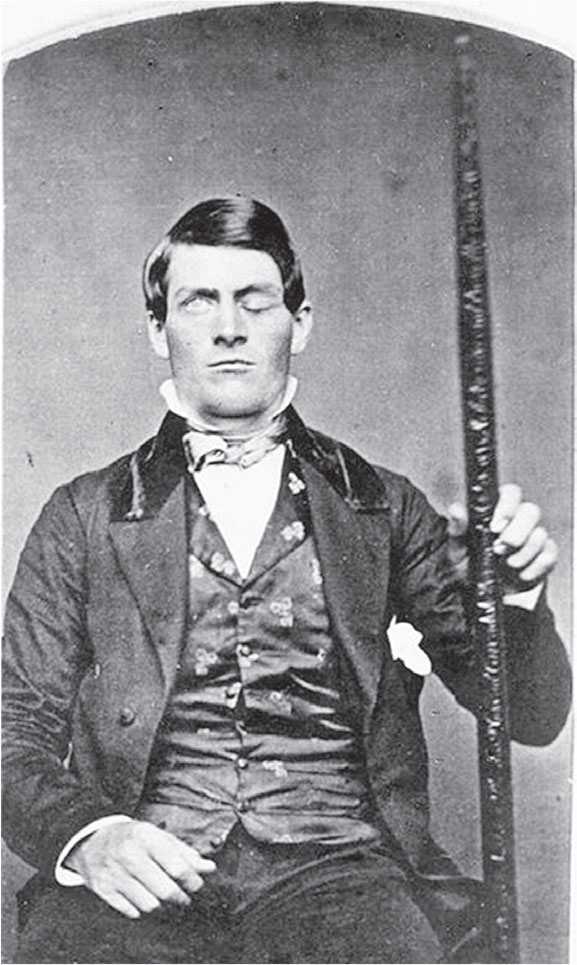 Phineas Gage holding the tamping iron that injured him In 2000 one - photo 4