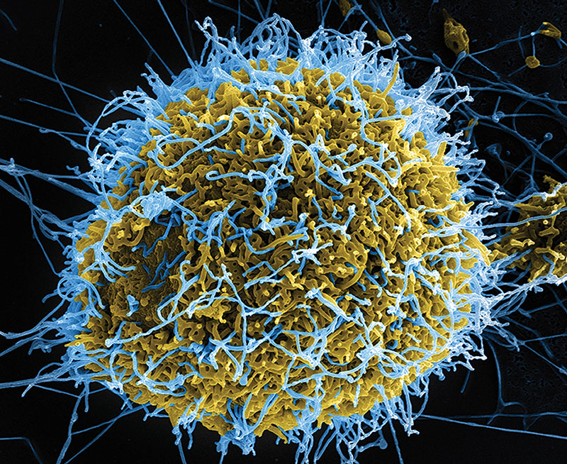 Ebola virus particles in a colored image from a scanning electron microscope - photo 3