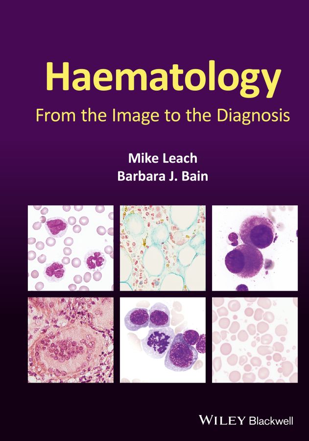 Table of Contents Guide Pages Haematology From the Image to the Diagnosis - photo 1
