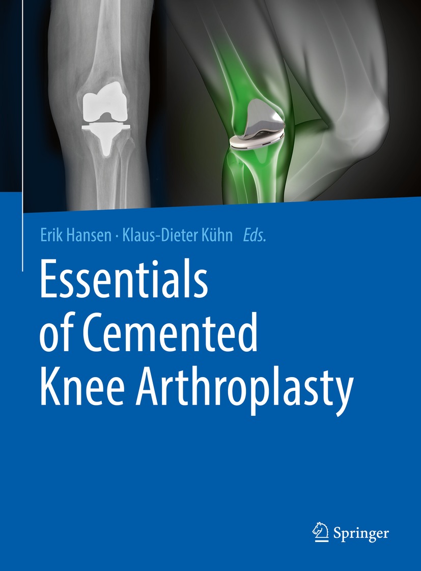 Book cover of Essentials of Cemented Knee Arthroplasty Editors Erik Hansen - photo 1