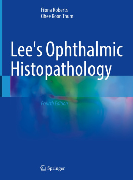 Fiona Roberts Lees Ophthalmic Histopathology