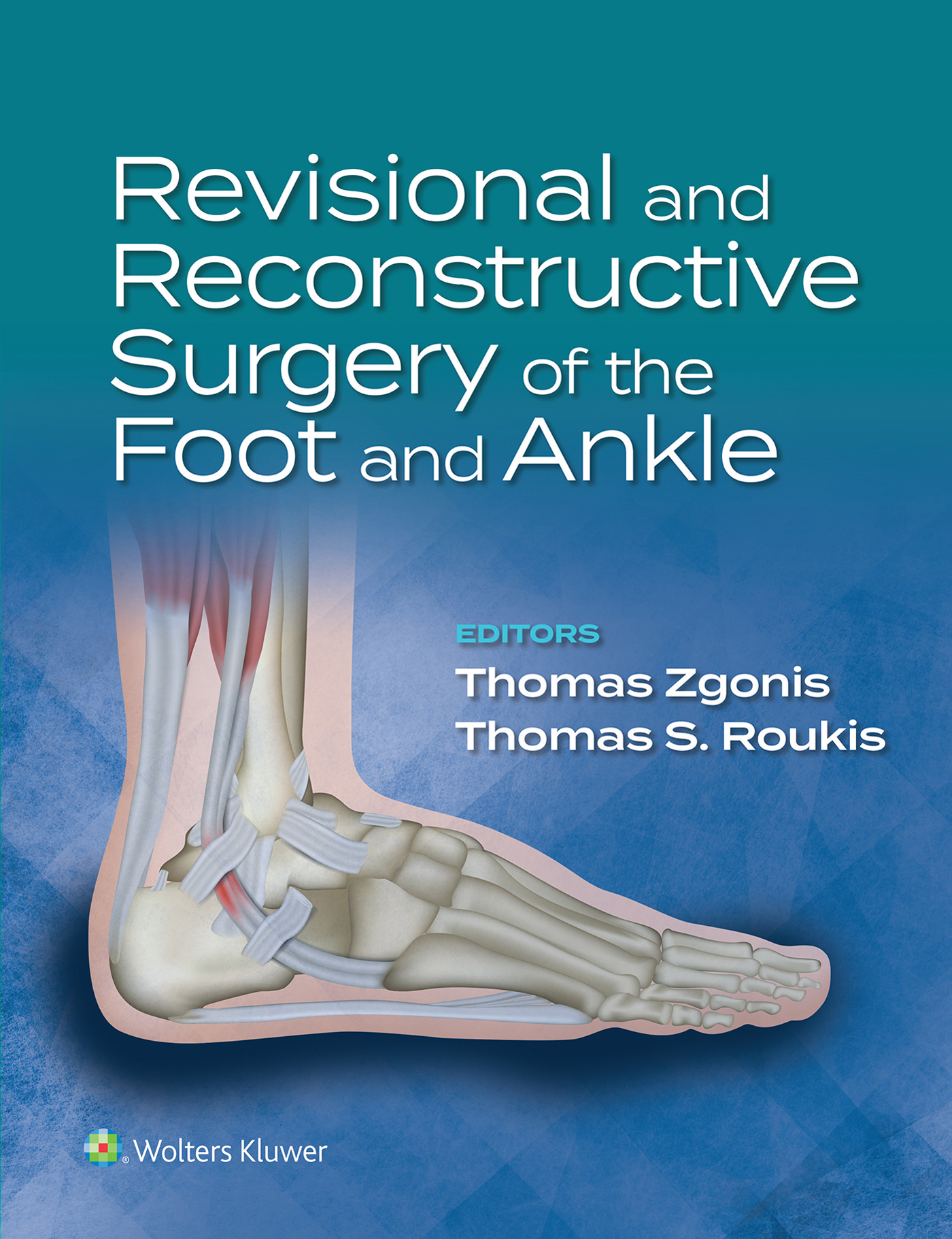 Revisional and Reconstructive Surgery of the Foot and Ankle Editions Thomas - photo 1