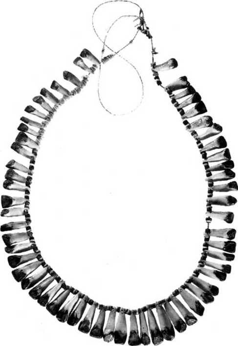 Necklace of 59 human teeth brought back by Jack Renton A detailed description - photo 2