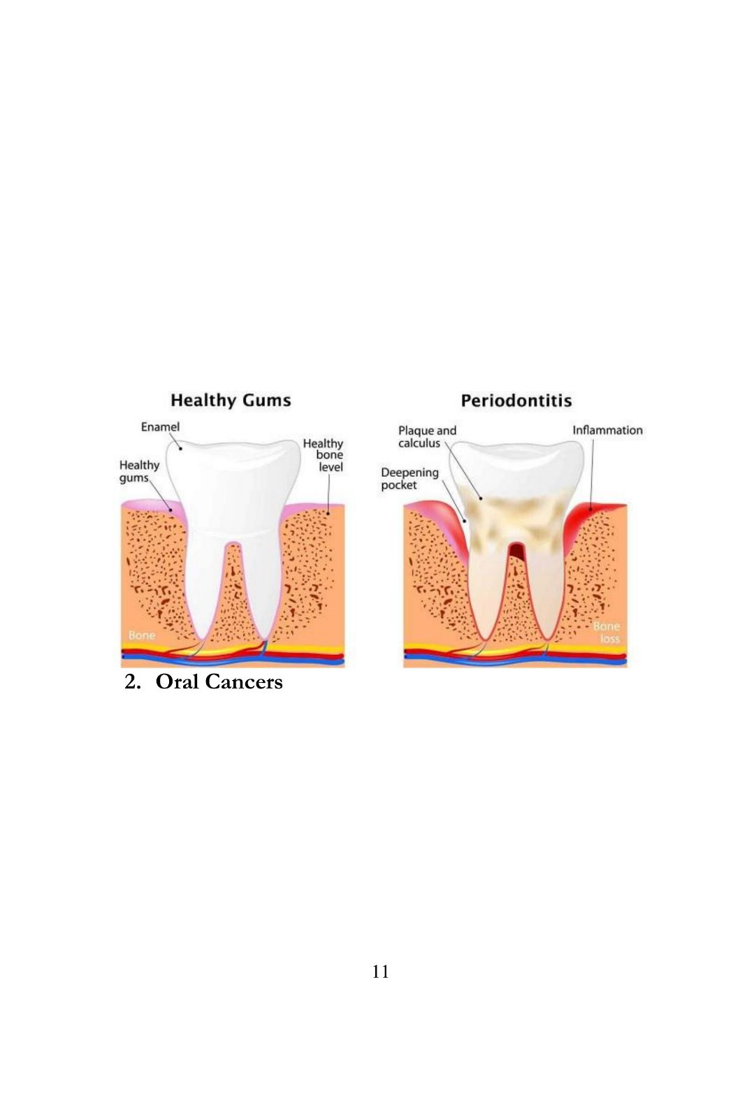 Adult Oral Health Dental Care and Tips for Adults Dental Care - photo 12