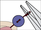 Diagram 3 Flattening a crimp Diagram 4 Flattening a cord end crimp - photo 11