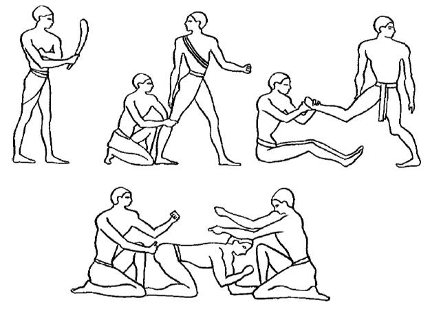 -- Fig 1 -- It should be noted that massage in a steam bath was extremely - photo 1