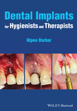 Ulpee R. Darbar - Dental Implants for Hygienists and Therapists