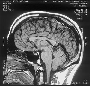 The authors brain seen through a conventional MRI scan Preface Kafkas Room - photo 5