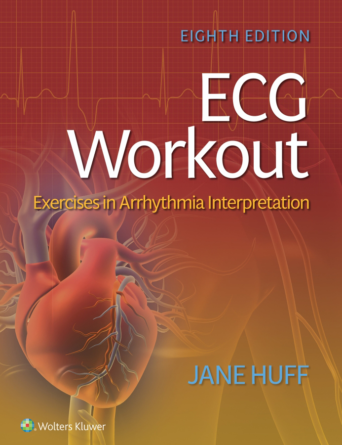 ECG WORKOUT EXERCISES IN ARRHYTHMIA INTERPRETATION - photo 1