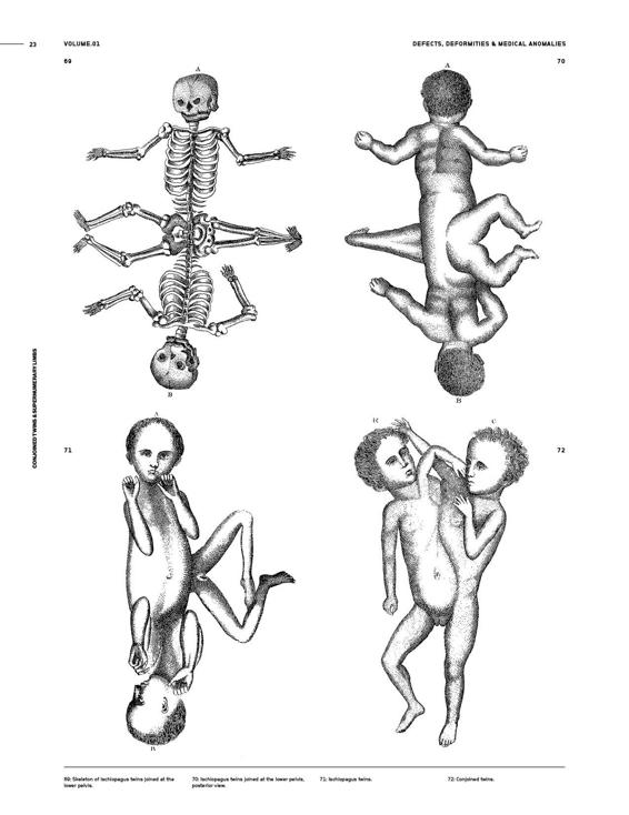 Medical Anomalies An Image Archive for Artists and Designers - photo 26