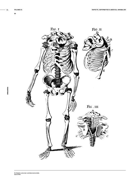 Medical Anomalies An Image Archive for Artists and Designers - photo 34