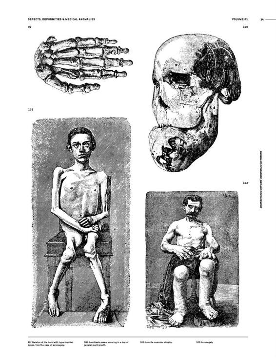 Medical Anomalies An Image Archive for Artists and Designers - photo 37