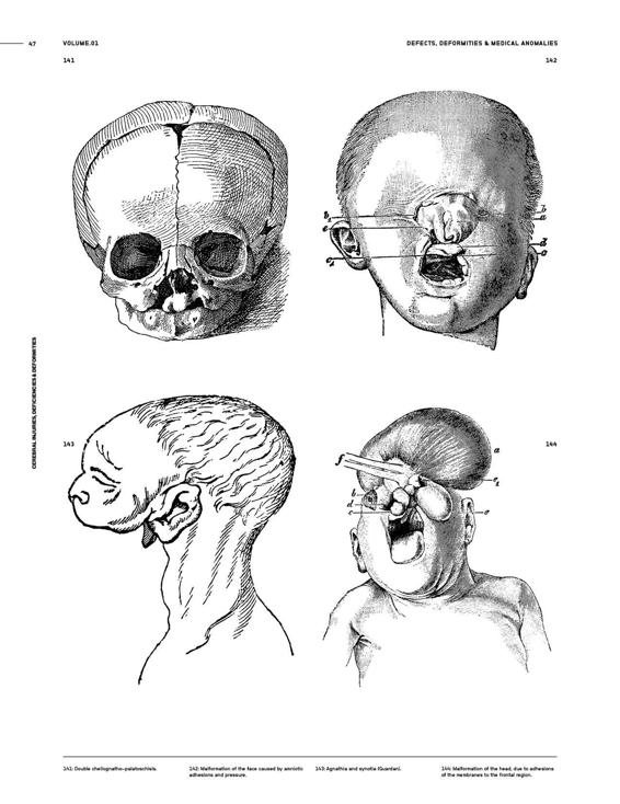 Medical Anomalies An Image Archive for Artists and Designers - photo 50