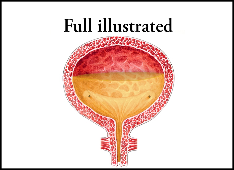 The First Edition of Urge Incontinence This chart was created by Anejo - photo 1