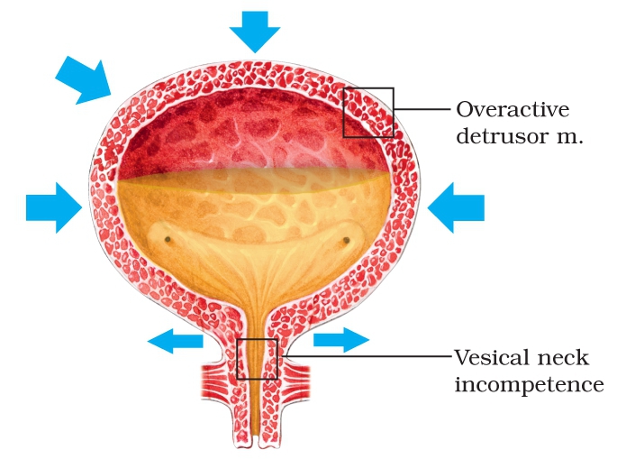 The vesical neck in charge of enabling urine to enter the proximal urethra is - photo 9