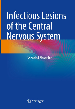 Vsevolod Zinserling Infectious Lesions of the Central Nervous System