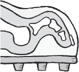 corn A hard circular callus on the toes which is caused by friction putting - photo 15