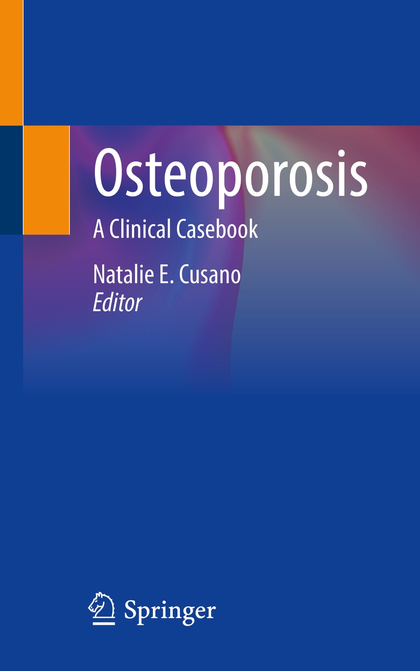 Book cover of Osteoporosis Editor Natalie E Cusano Osteoporosis A - photo 1