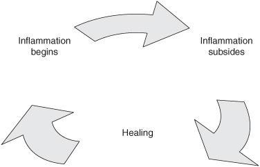 FIGURE 12 AS Inflammatory Disease Process CLASSIFICATION CRITERIA The - photo 4