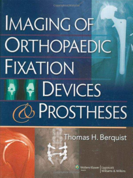 Thomas H. Berquist Imaging of Orthopaedic Fixation Devices and Prostheses