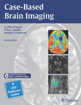 A. John Tsiouris - Case-Based Brain Imaging (RadCases)