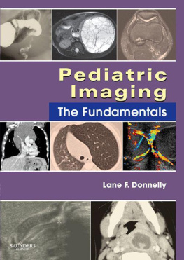 Lane F. Donnelly Pediatric Imaging E-Book: The Fundamentals