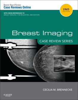 Cecilia Brennecke - Breast Imaging, (Case Review)