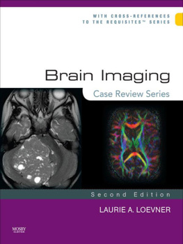 Laurie A. Loevner - Brain Imaging: Case Review Series (Case Review)