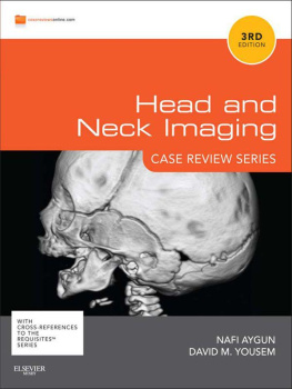 Nafi Aygun Head and Neck Imaging, (Case Review)